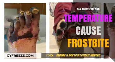 Above Freezing Frostbite: Understanding Cold Weather Risks Beyond Temperature