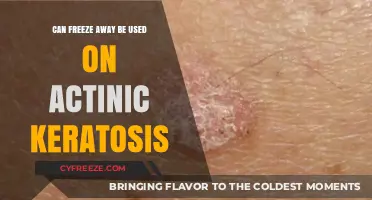 Can Freeze Away Treat Actinic Keratosis? Expert Insights and Advice