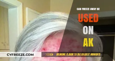 Can Freeze Away Safely Treat AKs? Expert Insights and Advice