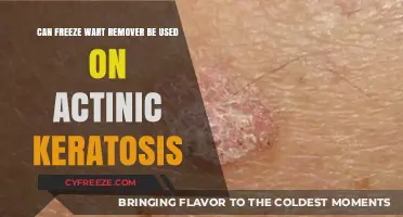 Can Freeze Wart Remover Treat Actinic Keratosis? Expert Insights Revealed