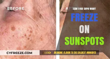 Cryo Wart Freeze for Sunspots: Safe and Effective Treatment Option?