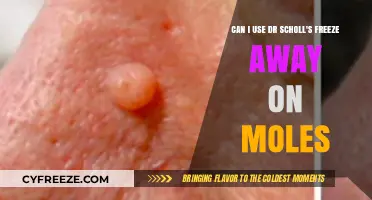 Using Dr. Scholl's Freeze Away on Moles: Safe or Risky?