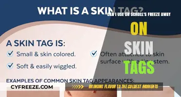 Using Dr. Scholl's Freeze Away for Skin Tags: Safe or Risky?