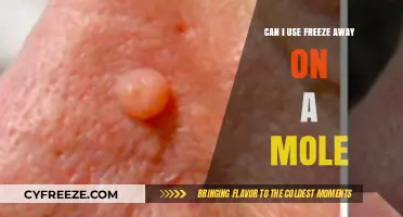 Is Freeze Away Safe for Mole Removal? Expert Advice and Risks