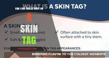 Using Freeze Away on Skin Tags: Safe, Effective, or Risky?