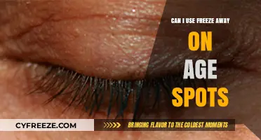 Using Freeze Away on Age Spots: Safe, Effective, or Risky?