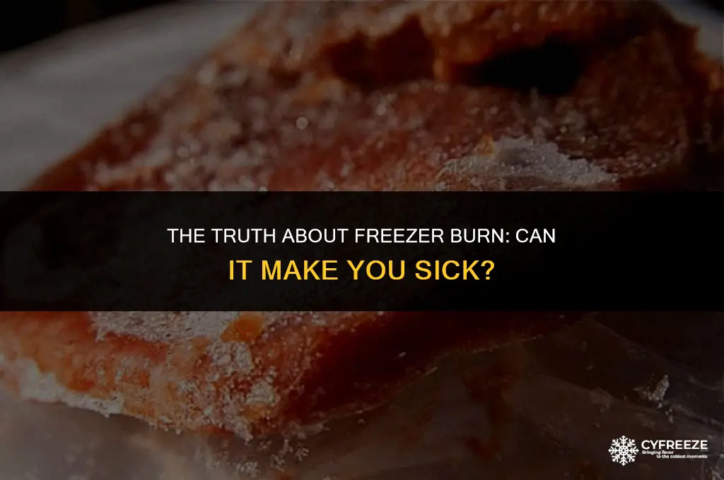 can salmon that freezer burn make you sick
