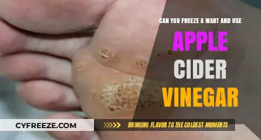 Freeze Warts and Apple Cider Vinegar: Effective Home Remedies?