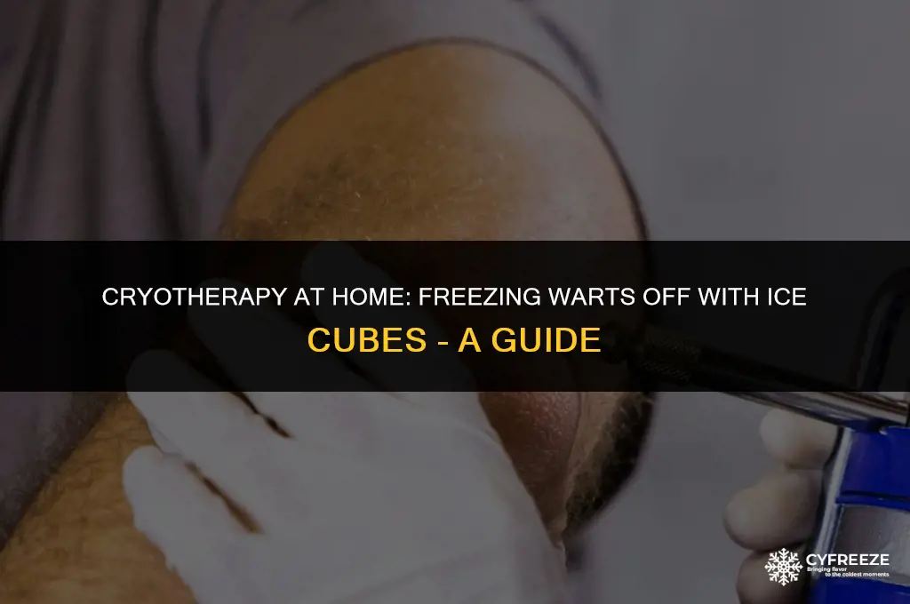 can you freeze a wart off with an ice cube