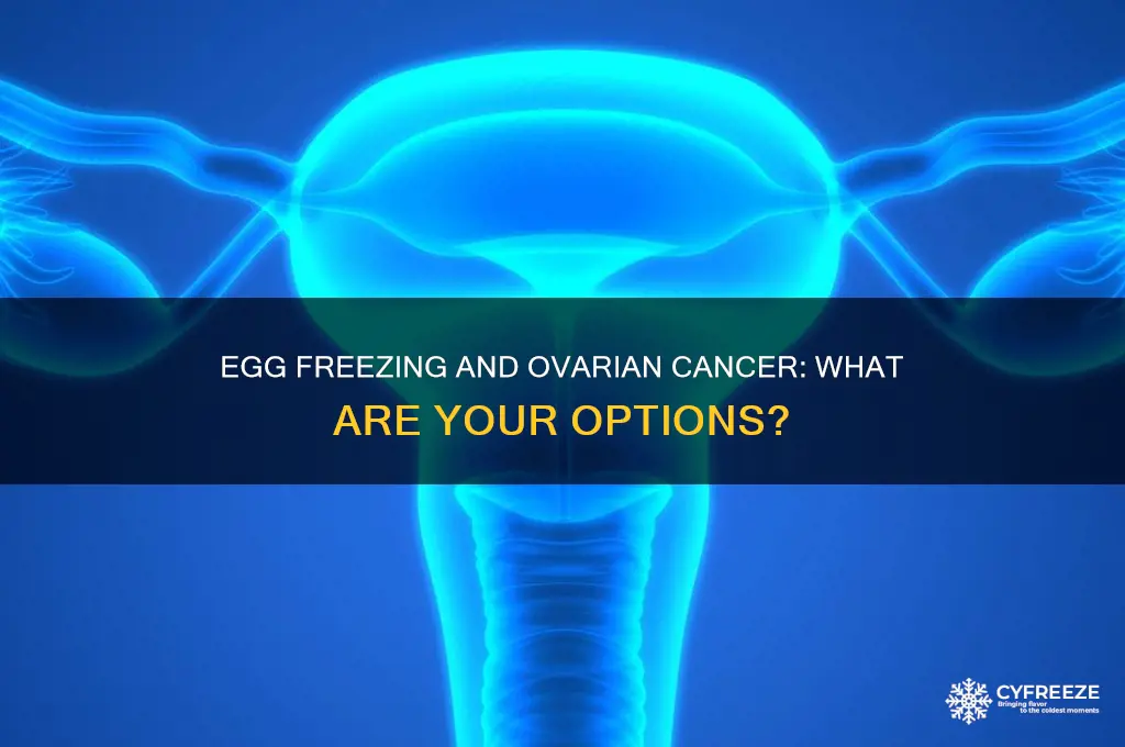 can you freeze your eggs if you have ovarian cancer