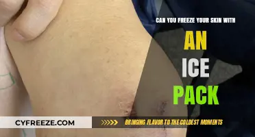 Chill Out: The Truth About Freezing Your Skin with Ice Packs