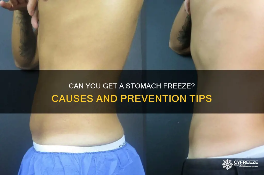 can you get a stomach freeze