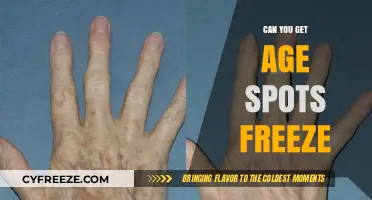 Freezing Age Spots: Effective Treatment or Temporary Solution?