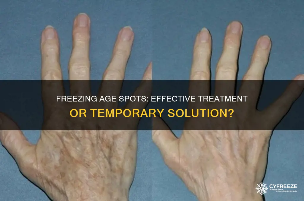 can you get age spots freeze