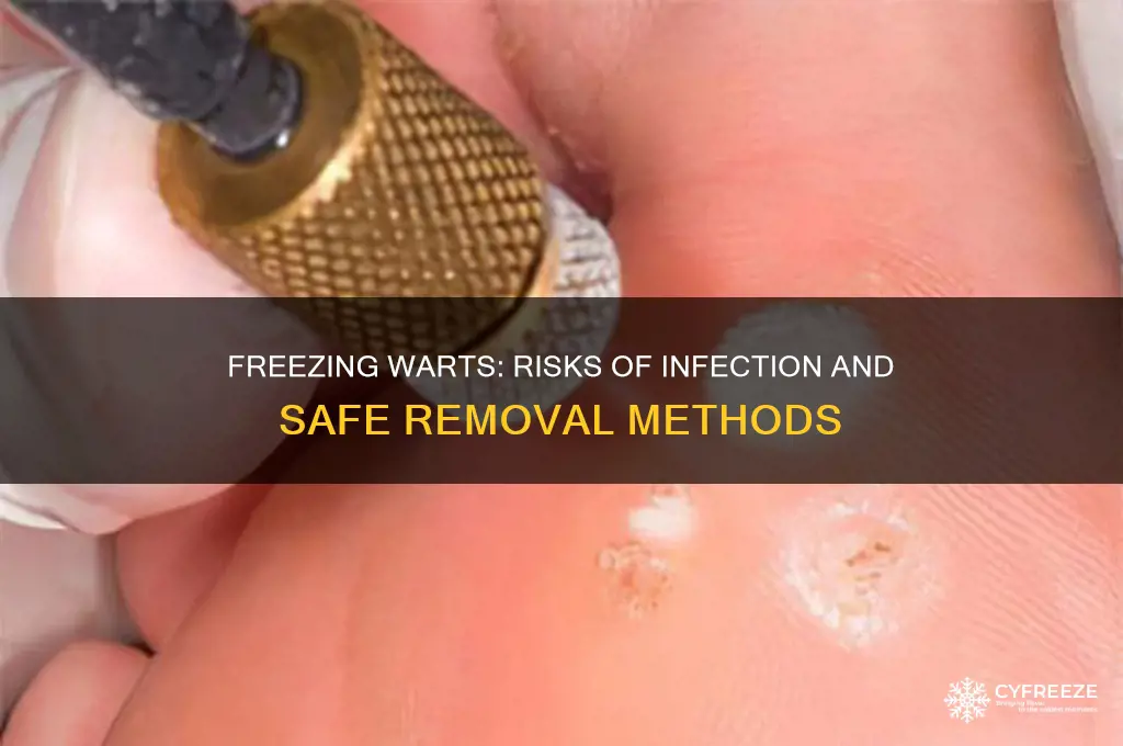 can you get an infection from freezing warts
