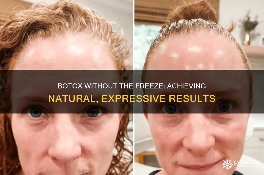 can you get botox and not completly freeze your face