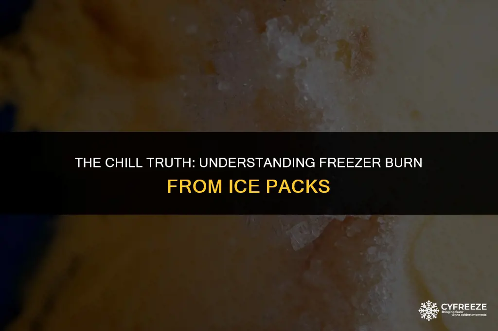 can you get freezer burn from an ice pack