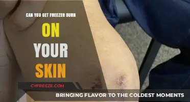 Can Freezer Burn Affect Your Skin? Unraveling the Chilling Truth