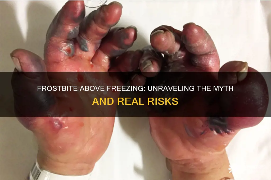 can you get frostbite above freezing