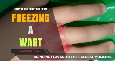 Freezing Warts: Frostbite Risk and Safe Removal Methods Explained