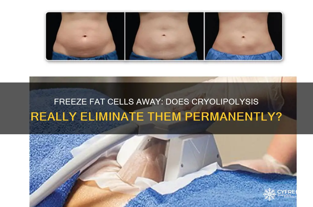 can you get rid of fat cells by freezing them