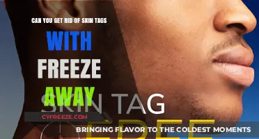 Freeze Away Skin Tags: Effective Removal Method or Myth?