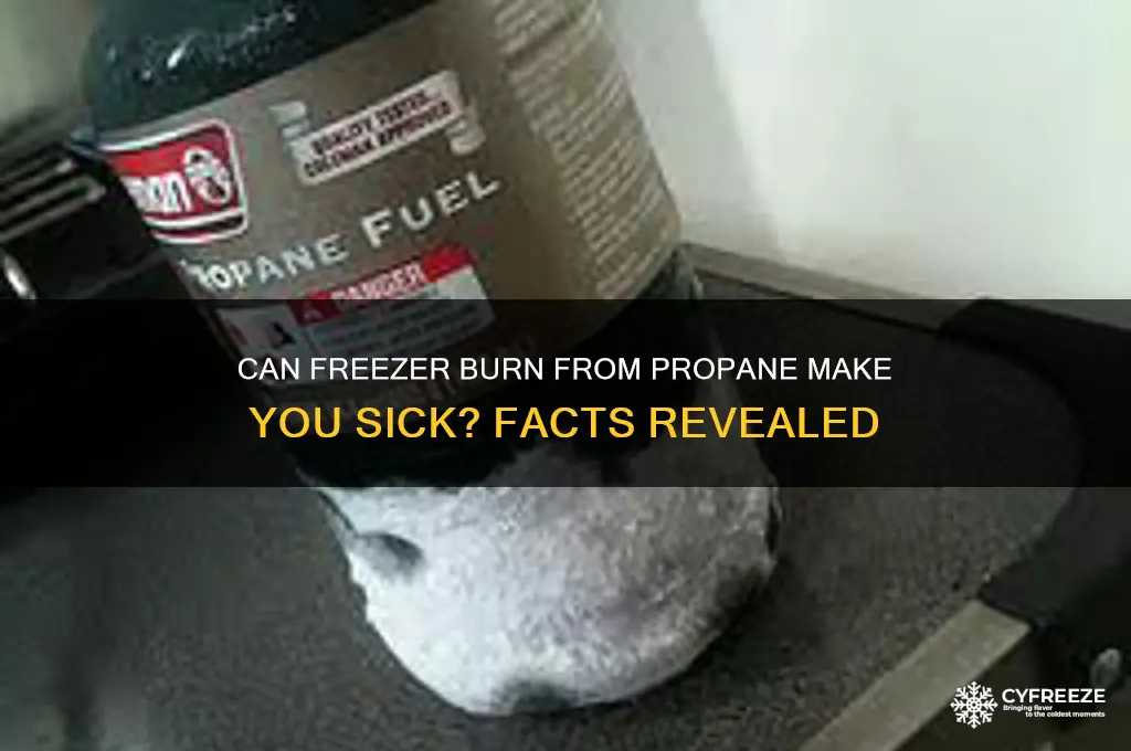 can you get sick from freezer burn from propane