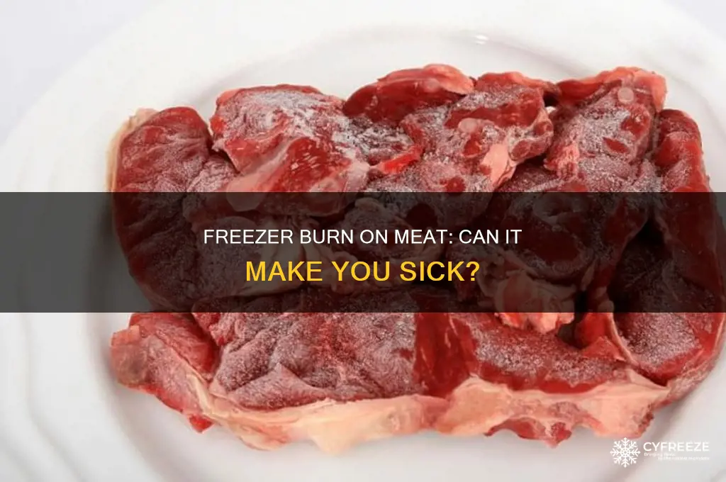 can you get sick from freezer burn meat
