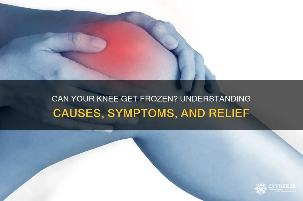 can you knee get freeze