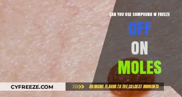 Using Compound W Freeze Off on Moles: Safe or Risky?