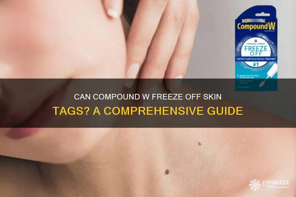 can you use compound w freeze off skin tags