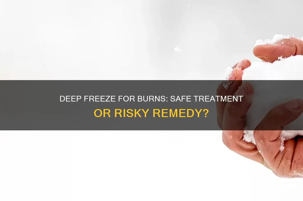can you use deep freeze on burns