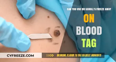 Using Dr. Scholl's Freeze Away on Blood Tags: Safe or Risky?