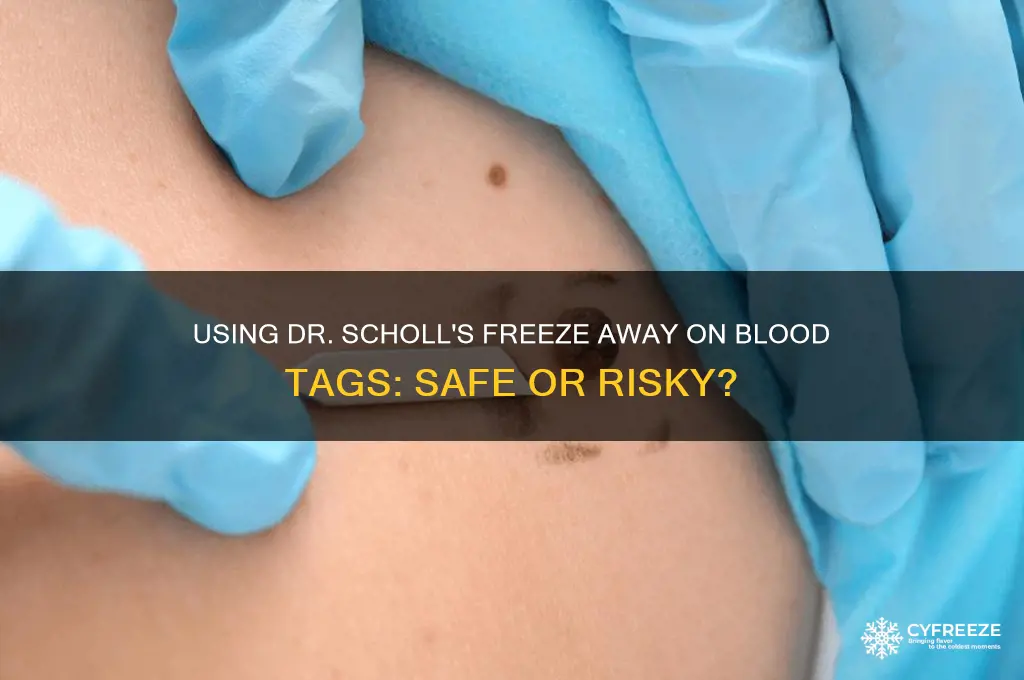 can you use dr scholl