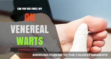 Using Freez Off on Venereal Warts: Safe and Effective Treatment?