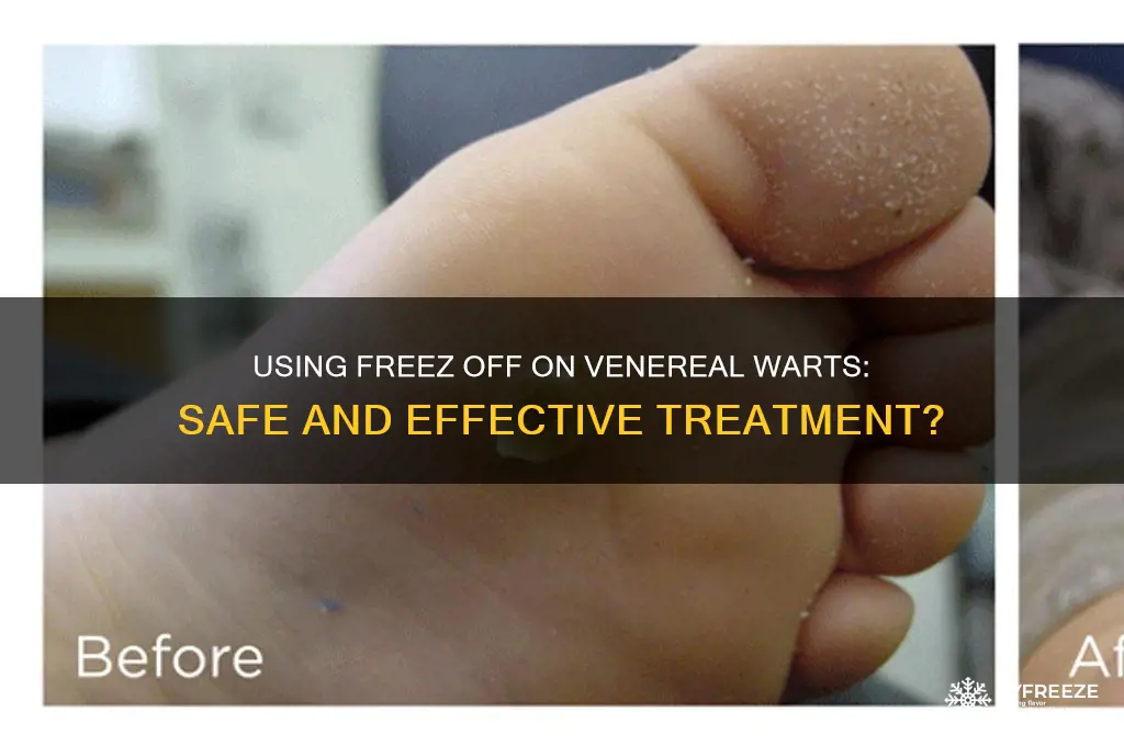 can you use freez off on venereal warts