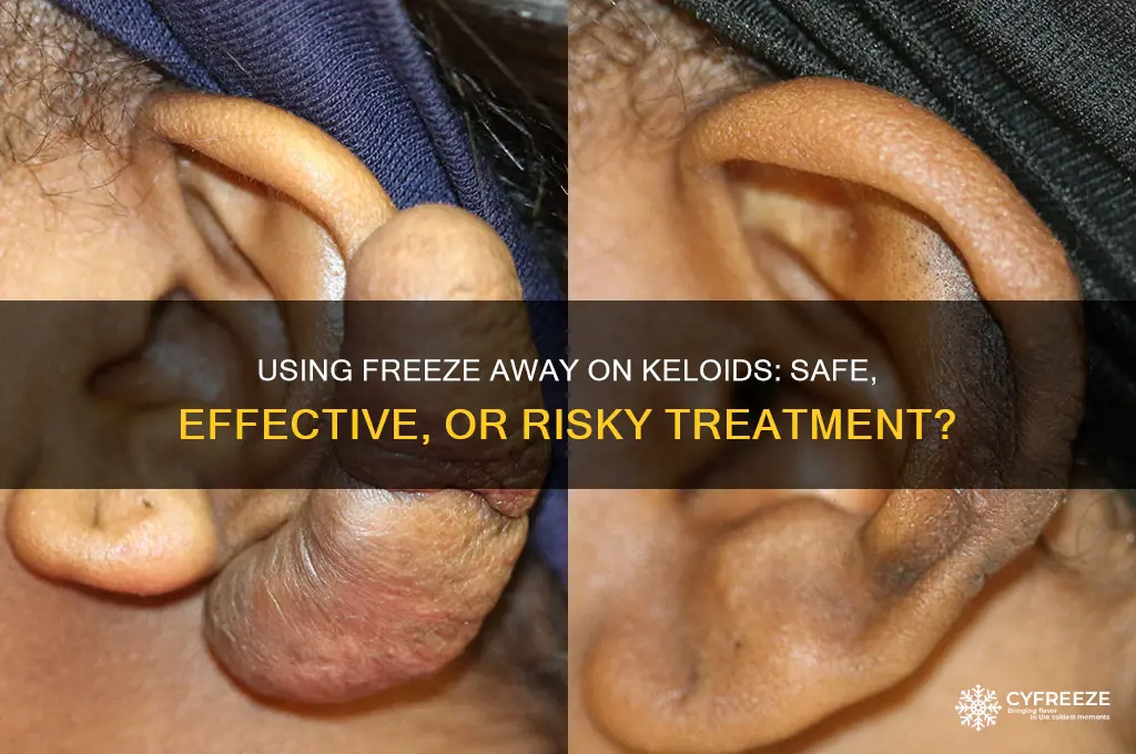 can you use freeze away on keloids
