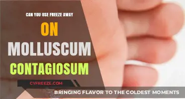 Freeze Away for Molluscum Contagiosum: Effective Treatment or Not?