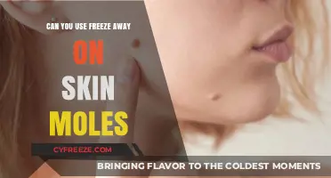 Using Freeze Away on Skin Moles: Safe, Effective, or Risky?