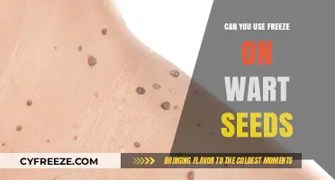 Can You Freeze Wart Seeds? Effective Removal Methods Explained