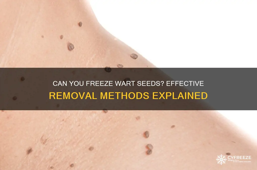 can you use freeze on wart seeds