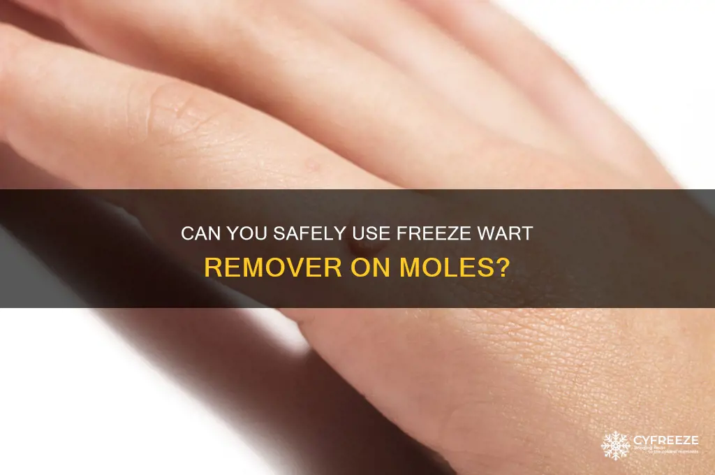 can you use freeze wart remover on moles