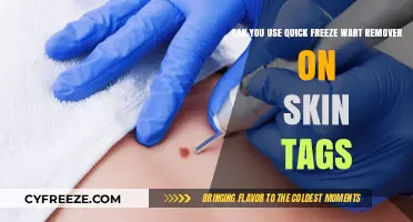 Quick Freeze Wart Remover: Safe for Skin Tags or Not?