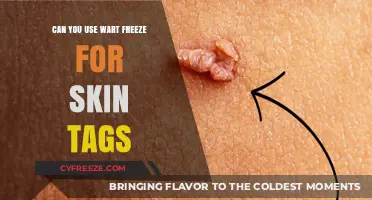 Using Wart Freeze for Skin Tags: Safe, Effective, or Risky?