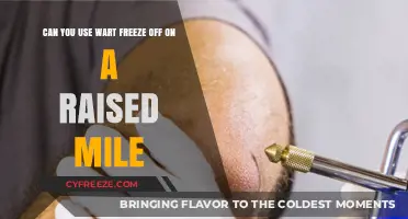 Using Wart Freeze Off on Raised Moles: Safe or Risky?