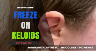 Wart Freeze for Keloids: Safe Treatment or Risky Approach?