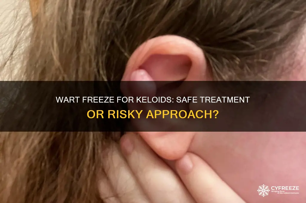 can you use wart freeze on keloids