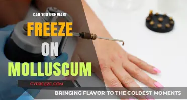 Wart Freeze for Molluscum: Safe Treatment Option or Risky Choice?