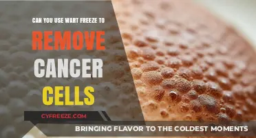 Wart Freeze for Cancer Cells: Safe, Effective, or Risky?