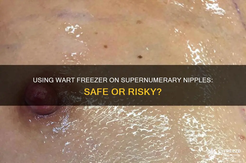 can you use wart freezer on third nipple